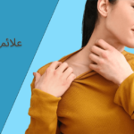 یک زن در حال خاراندن گردن خود بخاطر آلرژی به لباس در لباس خردلی رنگ